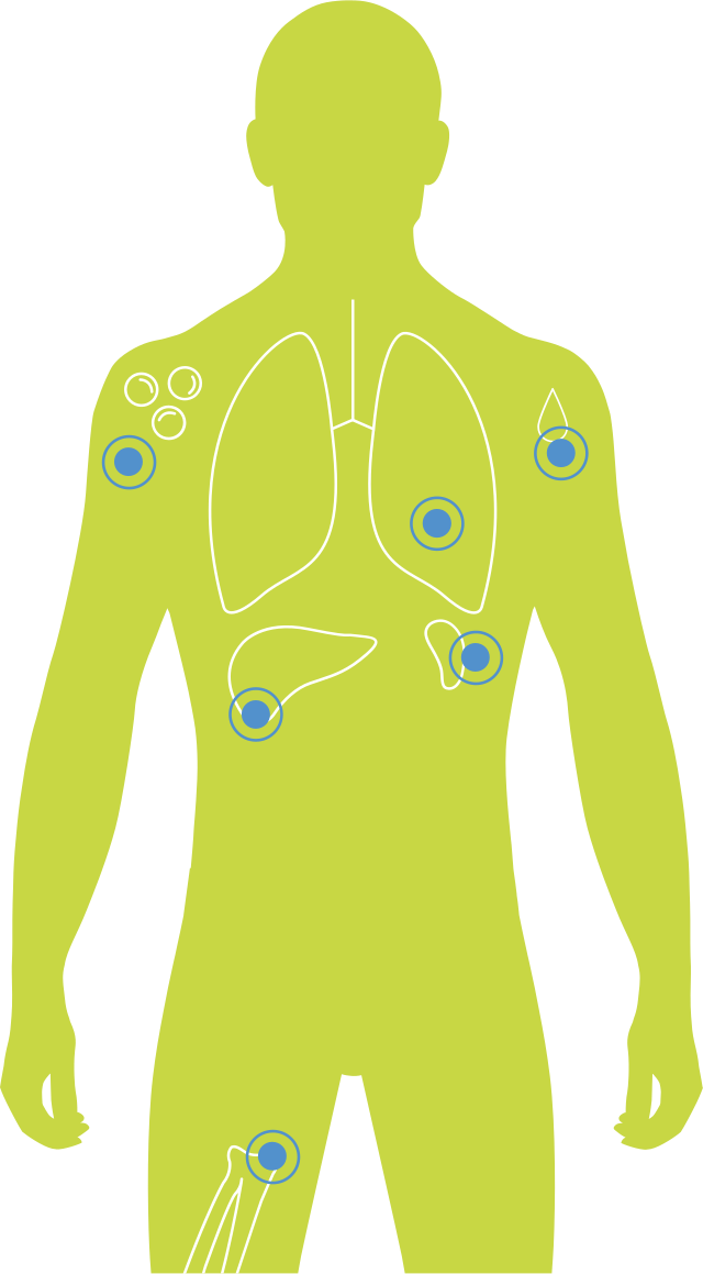 Hotspot image 